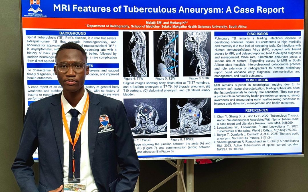 SMU radiography students shine on international stage